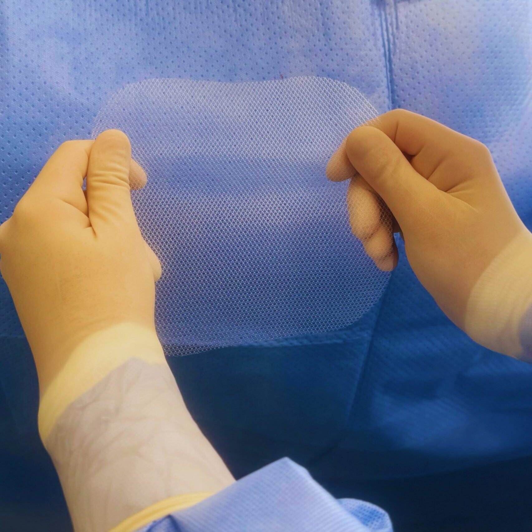 Tela na cirurgia de hérnia abdominal: o que é e quando é necessária