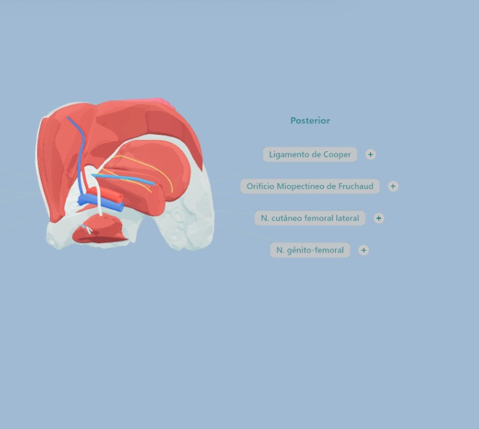 3D anatomical model of the inguinal region, hernia, Brazil